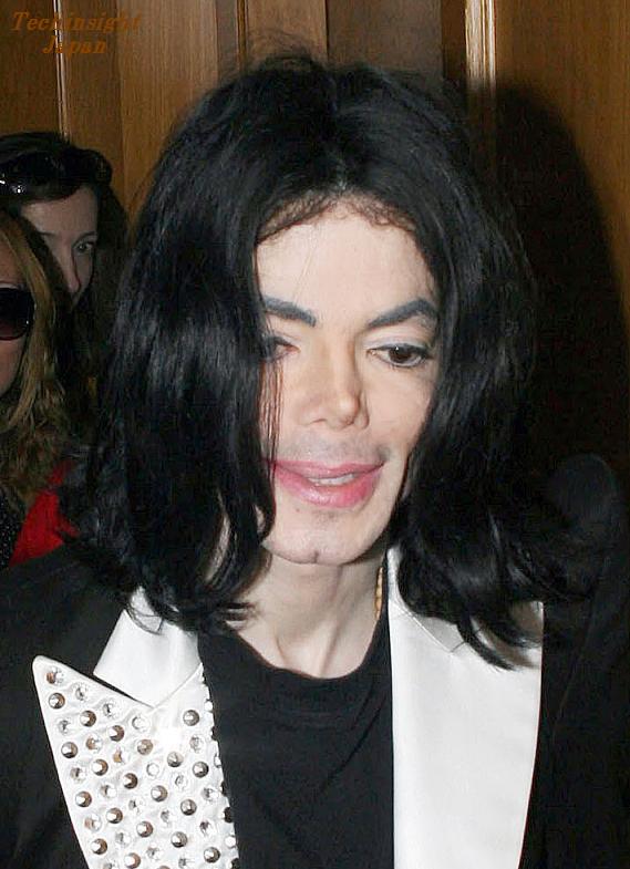 昨年6月29日、故マイケル・ジャクソンの自宅から発見された薬品類をロス市警がメディアに公開した。その中には噂の肌の漂白剤 “モノクイン” も。尋常性白斑症の患者にも使用者は多いとのこと。