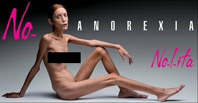 伊アパレル企業が2007年に発表した、拒食症撲滅キャンペーン・ポスター。自らの裸体をさらしたフランス人元モデルが病死。