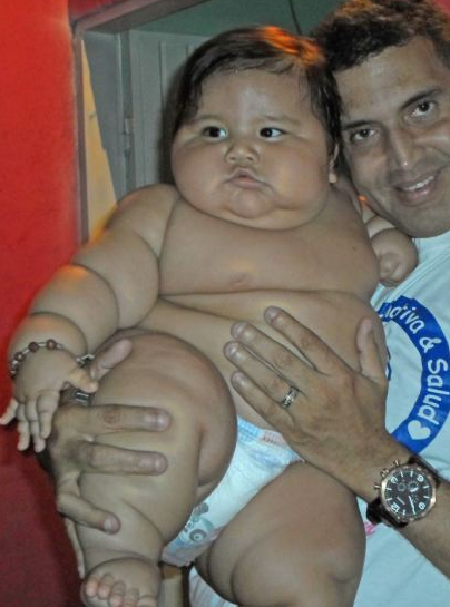 南米コロンビアの超肥満児は19.5kg。　画像はdailymail.co.ukのスクリーンショット