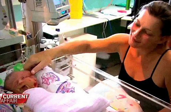 【豪州発！Breaking News】顔を2つ持った赤ちゃん生後19日で死亡。「それでも愛しい」と奇跡を信じた母親。（豪）