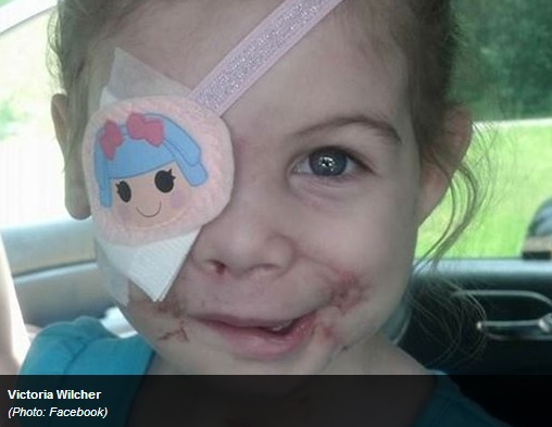 【米国発！Breaking News】米・KFC、犬に襲われ眼球を失った3歳女児を入店拒否。（ミシシッピ州）