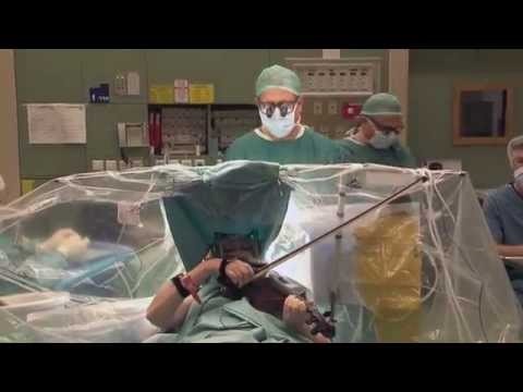 手術中にバイオリンを弾くElishuvさん。（画像はYouTubeのサムネイル）
