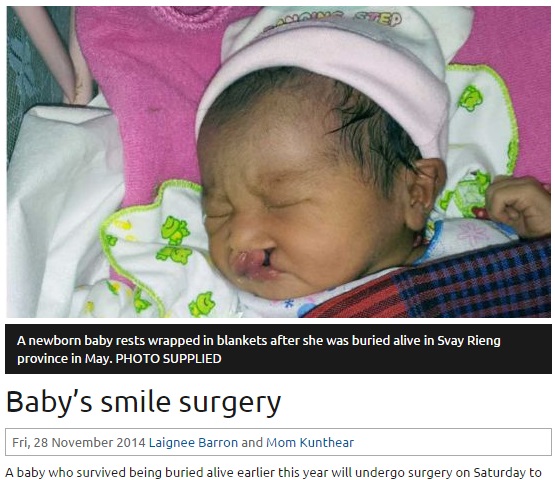 【海外発！Breaking News】口唇口蓋裂ゆえ父親に生き埋めにされた赤ちゃん。救出後、医師が無償で整形手術。（カンボジア）