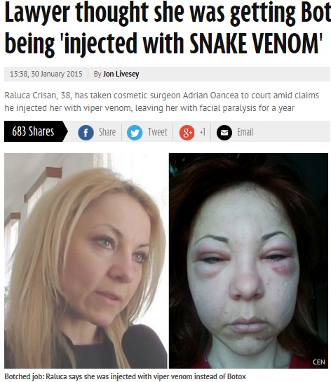 【海外発！Breaking News】ボトックス注射のはずが、中身は「ヘビ毒」。2年も麻痺に苦しむ女性。（ルーマニア）
