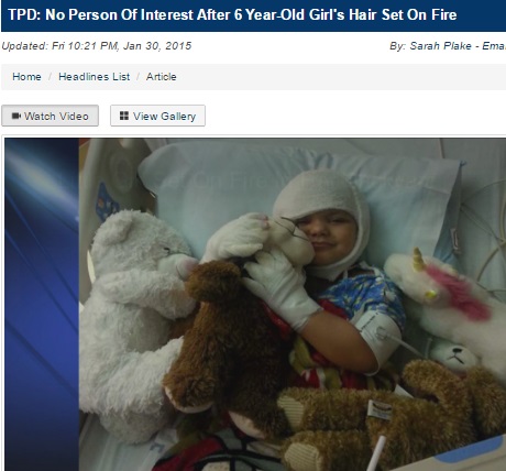 髪に火をつけられた6歳のジェイデンちゃん（画像はwibw.comのスクリーンショット）