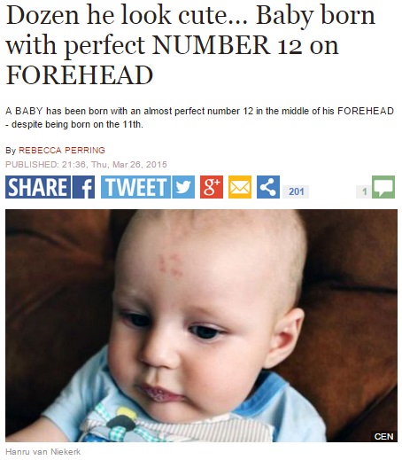 【海外発！Breaking News】額に“12”の文字がクッキリ。珍しい赤アザを持って生まれた赤ちゃん。（南ア）