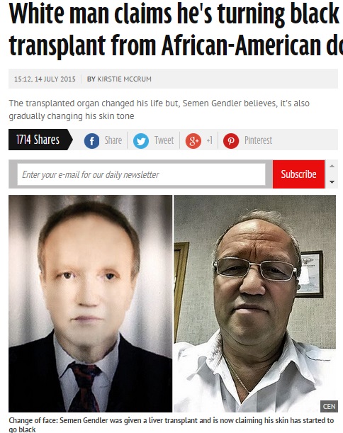 黒人からの肝移植を受けたロシアの白人男性（画像はmirror.co.ukのスクリーンショット）