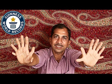 インドの男性の手指・足の指は計28本（出典：http://www.youtube.com）