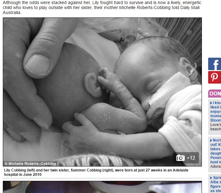 【海外発！Breaking News】超低出生体重児で産まれた双子　抱きしめあい困難乗り越える（豪）