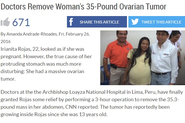 【海外発！Breaking News】22歳女性に16kgもの卵巣腫瘍　摘出手術が成功（ペルー）