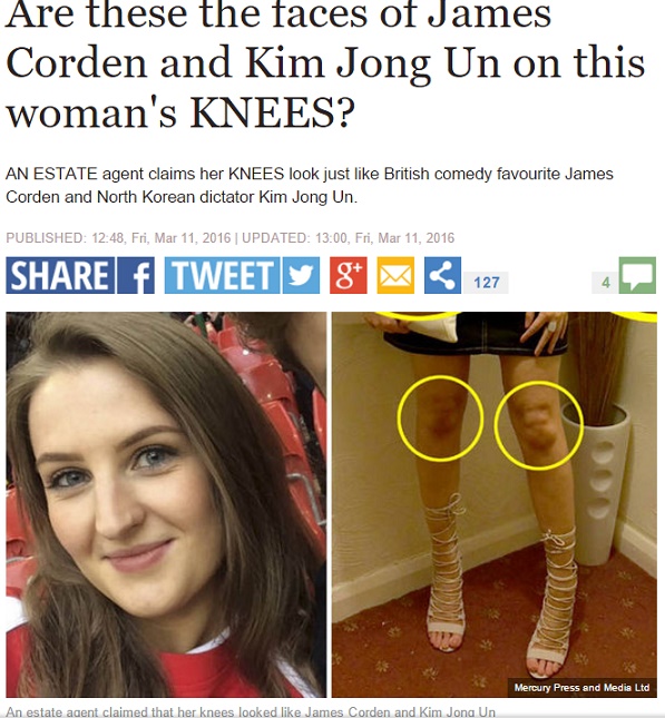 【海外発！Breaking News】両ヒザに現れた超有名人たち　英22歳女性の脚にご注目！