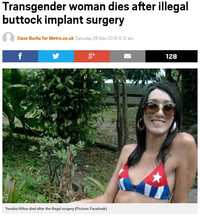 【海外発！Breaking News】「セクシーなヒップラインに」25歳女性、違法な豊尻手術で死亡（コロンビア）