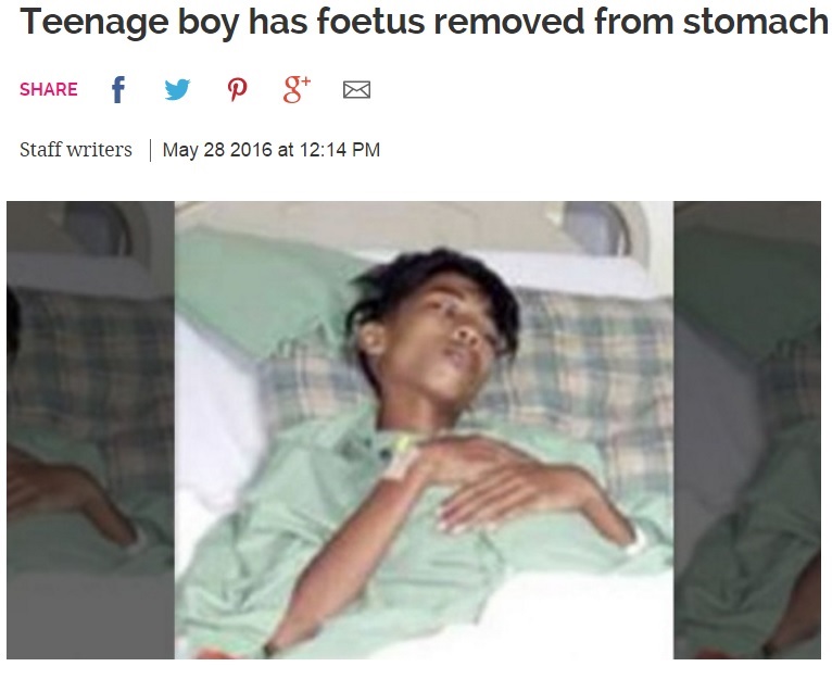【海外発！Breaking News】15歳少年の腹部から双子のもう一人　頭部、手足、生殖器も（マレーシア）