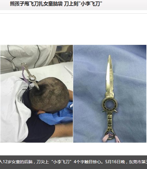 刃渡り15センチのナイフ、12歳少女の後頭部に（出典：http://news.163.com）