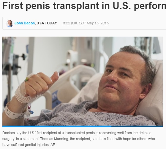 【海外発！Breaking News】米国で初のペニス移植　手術を受けた男性「戦傷兵達の希望につながれば」