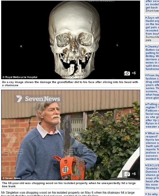 68歳男性、チェーンソーで顔を割るも自らの運転で病院へ（出典:http://www.dailymail.co.uk）