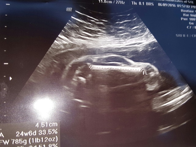 【海外発！Breaking News】妊娠した妻、超音波検査に映ったのはスポーツカー！　衝撃写真を夫が公開