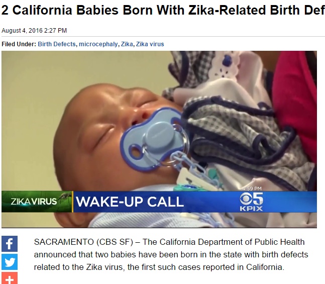 カリフォルニア州でも新生児に2例の「小頭症」（出典：http://sanfrancisco.cbslocal.com）