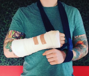エド・シーランが公開した写真（画像は『Ed Sheeran　2017年10月16日付Instagram「Ive had a bit of a bicycle accident and I’m currently waiting on some medical advice, which may affect some of my upcoming shows.」』のスクリーンショット）