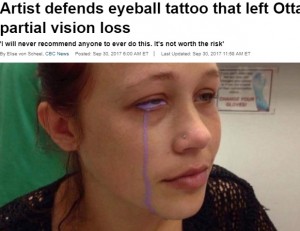 目にタトゥーを入れたもののインクが流れ出してしまった女性（画像は『CBS News　2017年9月30日付「Artist defends eyeball tattoo that left Ottawa woman with partial vision loss」（Catt Gallinger / Supplied）』のスクリーンショット）