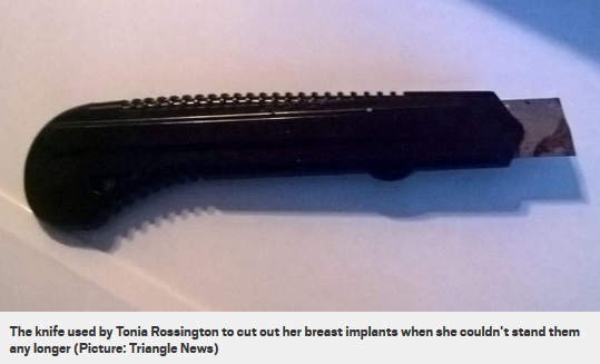 インプラント除去に使われたカッターナイフ（画像は『Metro　2018年4月23日付「Woman cut out her own breast using scalpel, Dettol and a YouTube tutorial」（Picture: Triangle News）』のスクリーンショット）