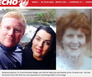7月に子供が誕生するカップルと妊婦の祖母メアリーさん（画像は『Liverpool Echo　2018年4月26日付「Mum-to-be shocked to see ‘dead grandmother’s face’ in baby scan」』のスクリーンショット）