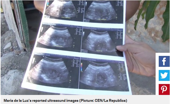 「妊娠6か月の赤ちゃんがいる」という超音波検査の写真（画像は『Metro　2018年5月21日付「‘Pregnant’ woman, 70, claims she’s going to be the oldest mother in history」（Picture: CEN/La Republica）』のスクリーンショット）