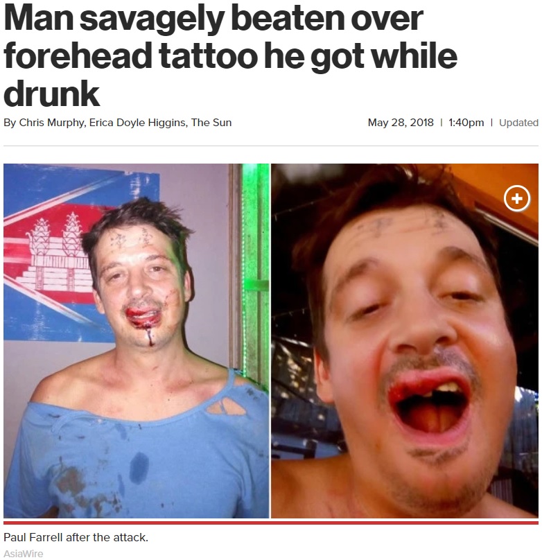 額のタトゥーがきっかけで暴行を受けたポールさん（画像は『New York Post　2018年5月28日付「Man savagely beaten over forehead tattoo he got while drunk」（AsiaWire）』のスクリーンショット）