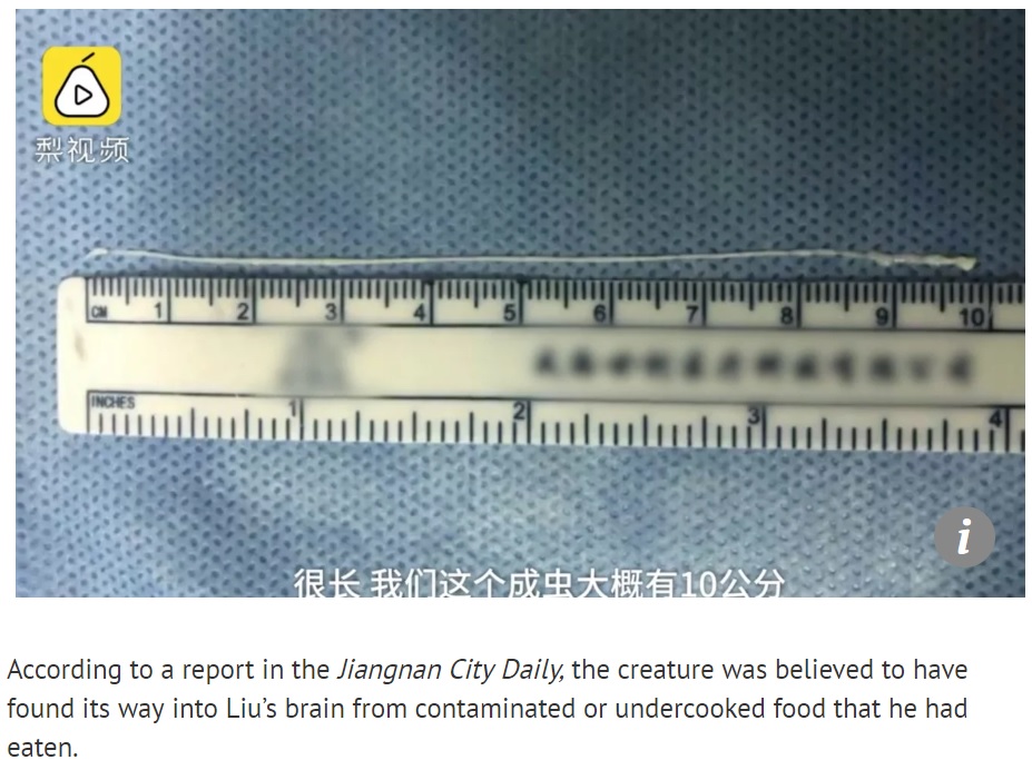 摘出された10センチの条虫（画像は『South China Morning Post　2018年9月12日付「Chinese doctors pull 10cm live worm from grilled food lover’s brain」（Photo: Pear Video）』のスクリーンショット）