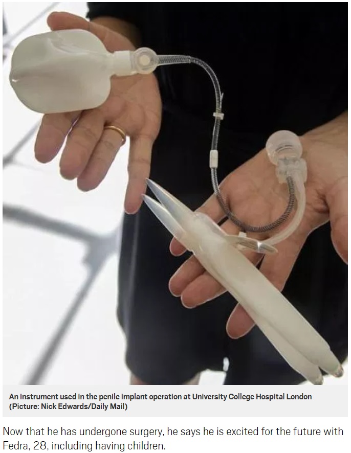 人工陰茎の手術で使用された器具（画像は『Metro　2018年9月28日付「Man given bionic penis ‘went into five-day coma a week after having sex for the first time’」（Picture: Nick Edwards/Daily Mail）』のスクリーンショット）