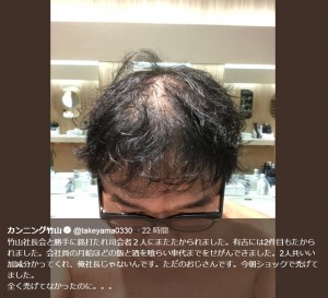 「今朝ショックで禿げてました」と竹山（画像は『カンニング竹山　2018年10月30日付Twitter「竹山社長会と勝手に銘打たれ司会者2人にまたたかられました。」』のスクリーンショット）