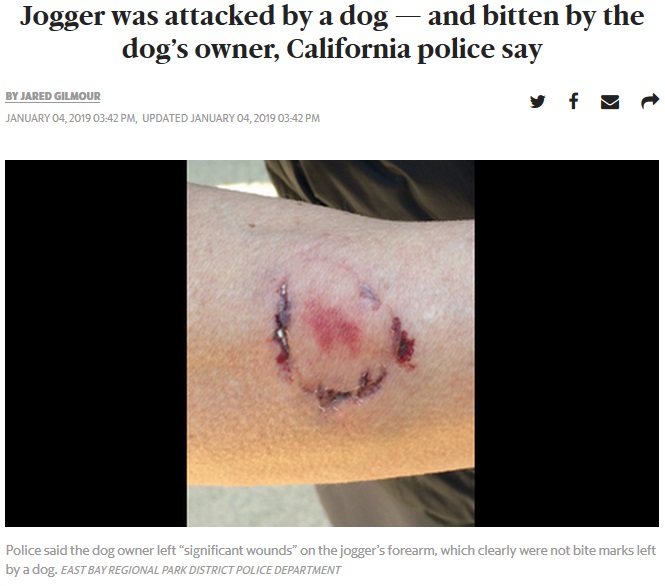 飼い主に噛みつかれた腕（画像は『Miami Herald　2019年1月4日付「Jogger was attacked by a dog — and bitten by the dog’s owner, California police say」（East Bay Regional Park District Police Department）』のスクリーンショット）