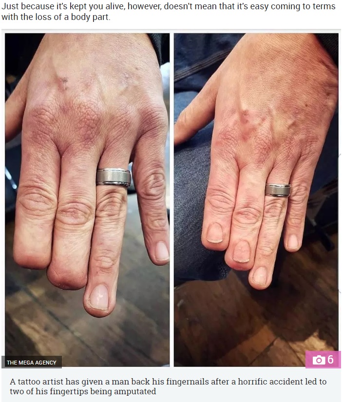 指先を失った男性に爪のタトゥーが施される（画像は『The Sun　2019年1月21日付「NAILED IT Man who had finger tips amputated has incredible new nails tattooed on」（Credit: THE MEGA AGENCY）』のスクリーンショット）