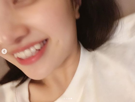 「可愛い歯並びなのにもったいない」の声も（画像は『百田夏菜子 ももいろクローバーZ　2019年2月6日付Instagram「好きって言ってくださる方も多いので....」』のスクリーンショット）