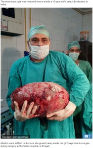 ベテラン医師もその大きさに驚く（画像は『The Sun　2019年4月22日付「GRUESOME GROWTH Doctors remove huge 15kg tumour from inside 16-year-old girl’s womb」（Credit: SWNS:SOUTH WEST NEWS SERVICE）』のスクリーンショット）