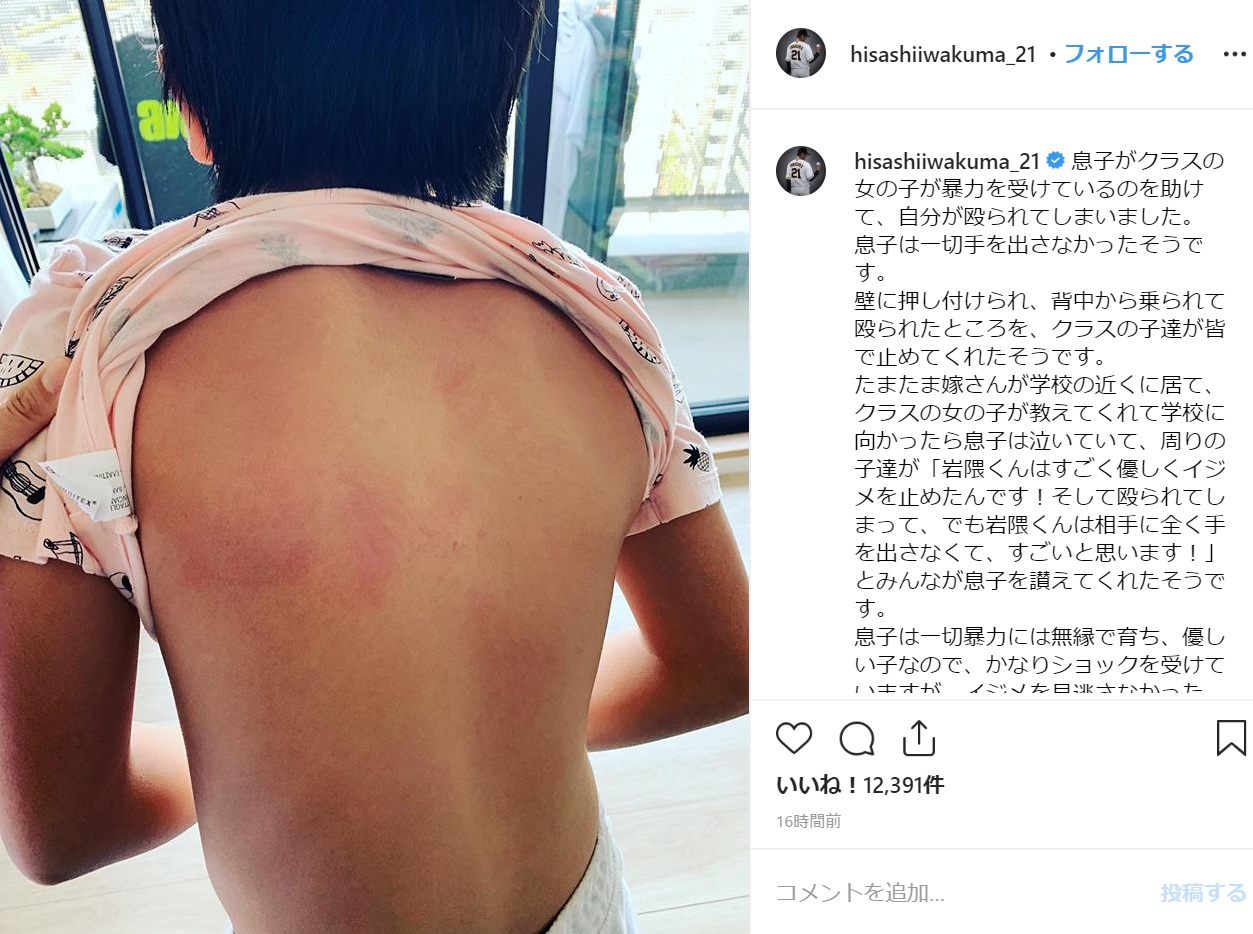 長男の背中の写真を公開した岩隈久志投手（画像は『Hisashi Iwakuma（岩隈 久志）　2019年5月30日付Instagram「息子がクラスの女の子が暴力を受けているのを助けて、自分が殴られてしまいました。」』のスクリーンショット）