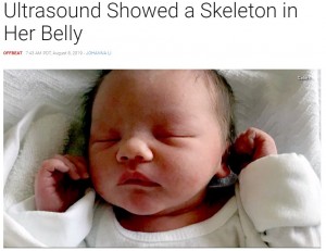 無事に誕生したサイラス君（画像は『Inside Edition　2019年8月8日付「Pregnant Mom ‘Freaked Out’ When Ultrasound Showed a Skeleton in Her Belly」（Caters）』のスクリーンショット）