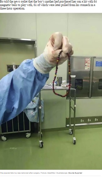 男児の胃から摘出されたマグネットボール（画像は『news.com.au　2019年8月21日付「Doctors find popular kids toy in six-year-old’s stomach」（Picture: Asiawires / Australscope）』のスクリーンショット）