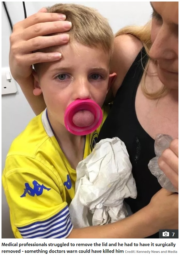 ボトルの飲み口から舌が抜けなくなったライリー君（画像は『The Sun　2019年7月25日付「‘HE NEARLY DIED’ Boy, 6, ‘needed life-saving operation’ to free tongue stuck in Sainsbury’s water bottle lid」（Credit: KENNEDY NEWS AND MEDIA）』のスクリーンショット）