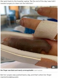 重度の感染症で手術する羽目に…（画像は『The Sun　2019年8月5日付「BUMPY RIDE Woman nearly lost her finger when a little red bump turned into a flesh-rotting infection after a trip to the nail salon」（Credit: FACEBOOK）』のスクリーンショット）
