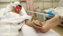 【アジア発！Breaking News】事故で切断された手を諦めなかった男性、足首から手が生える姿で1か月間。（中国）
