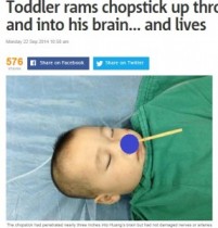 【海外発！Breaking News】箸が鼻から脳へと突き刺さった2歳児。奇跡的に損傷を免れる。（中国）