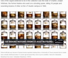 【海外発！Breaking News】テキサス大学で起きた「脳の標本盗難事件」、意外な幕引きに批判が集中。（米）