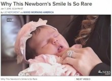 【海外発！Breaking News】誕生した赤ちゃんの口にすでに2本の前歯！　病院やママもびっくり。（米）