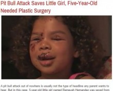 【海外発！Breaking News】顔面に大怪我の5歳女児。襲ったのは飼い犬のピットブルか、隣人宅のラブラドールか。（米）