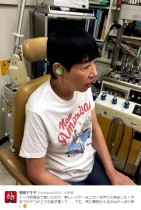【エンタがビタミン♪】和田アキ子“耳”でも伝説作る。医師も「1000人で3本の指に入る」