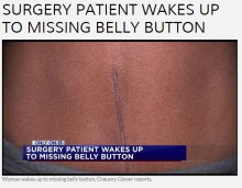 【海外発！Breaking News】腹部のたるみ除去手術でヘソを失った米女性