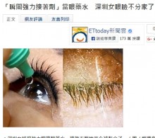 【海外発！Breaking News】20歳の女性、瞬間接着剤を瞳に　目薬と勘違い（中国）