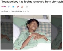 【海外発！Breaking News】15歳少年の腹部から双子のもう一人　頭部、手足、生殖器も（マレーシア）