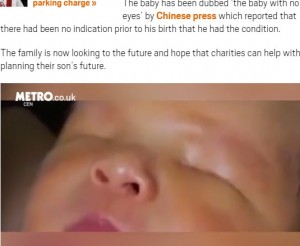 【海外発！Breaking News】中国で増え続ける奇形を伴った赤ちゃんの誕生　今度は無眼球症の男児